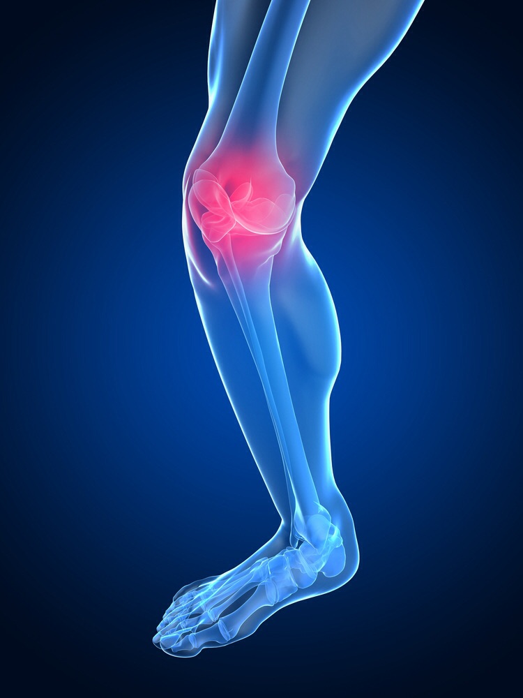 Kneegeneral